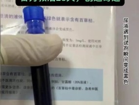 男子喝下百草枯28天：肺部轻微纤维化 生还奇迹